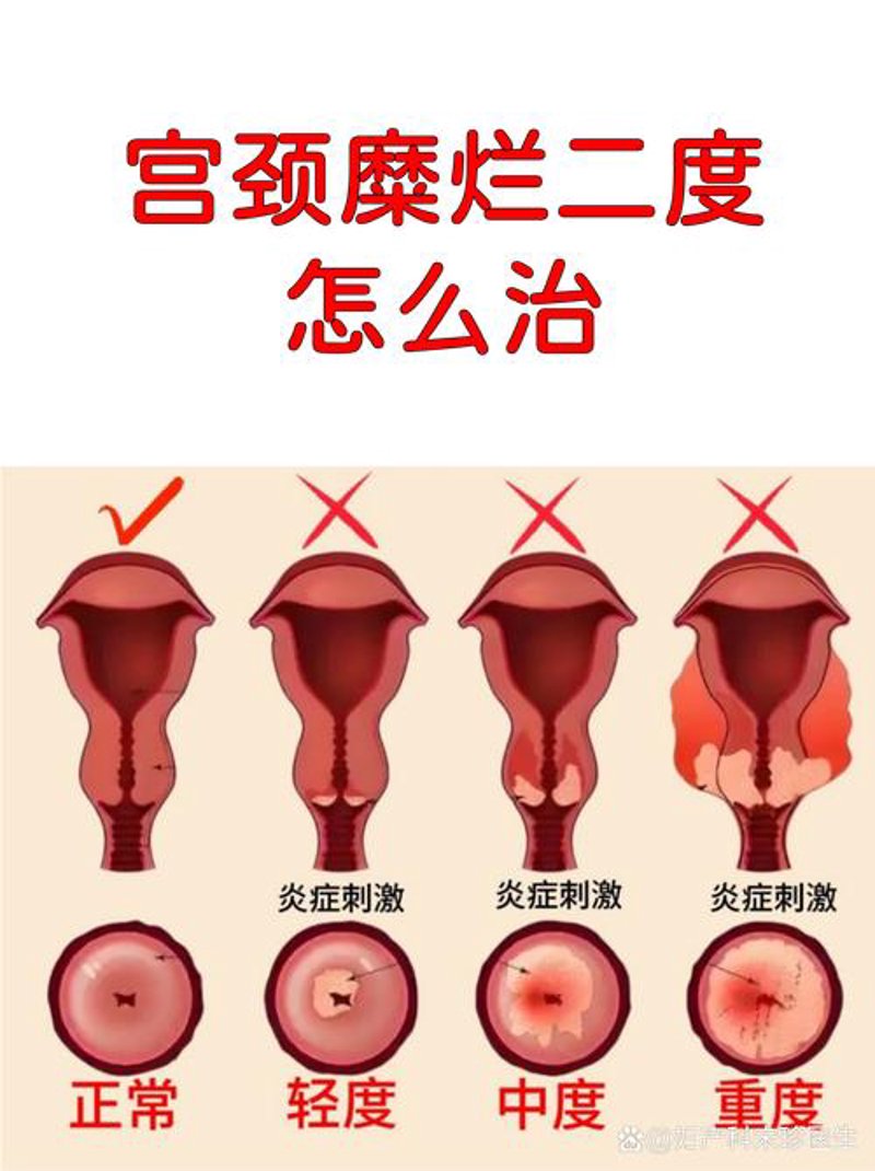 商丘妇科医院哪家更值得信赖？