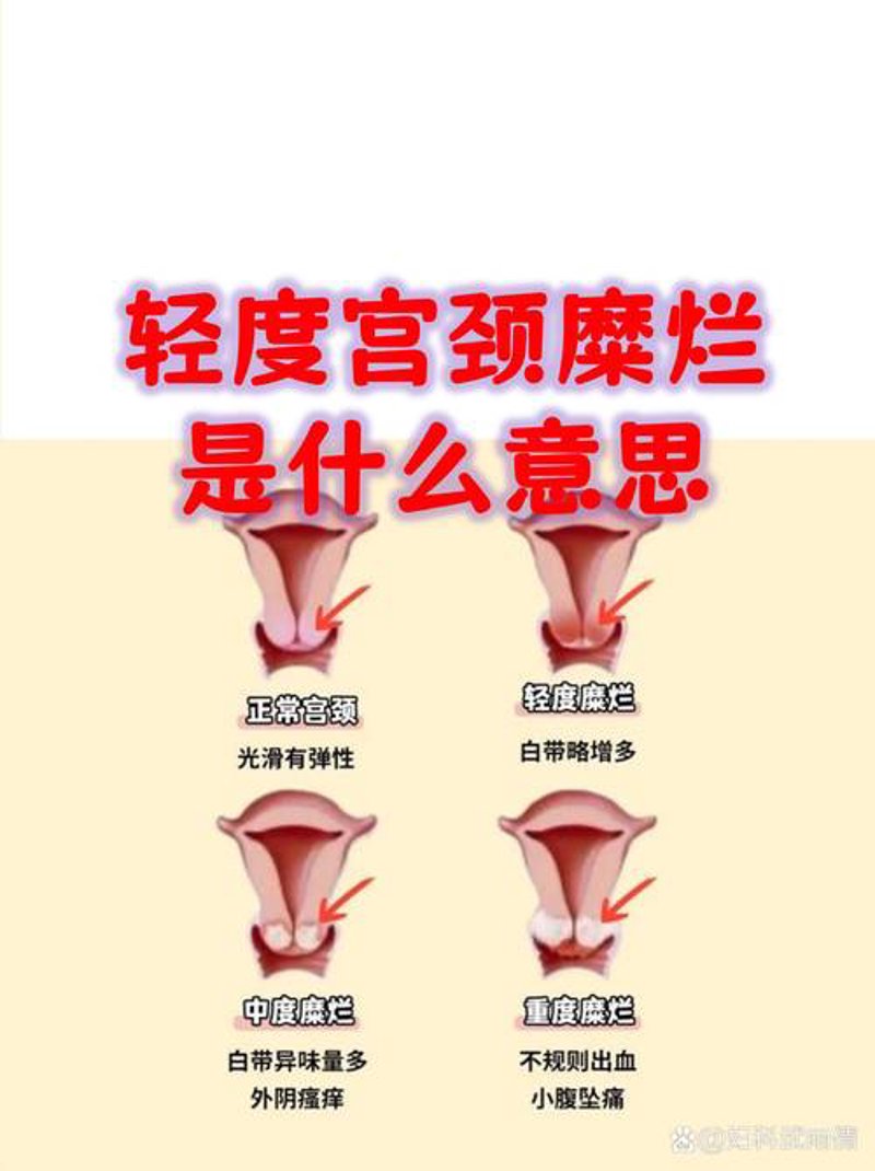 商丘妇科医院：守护女性健康新篇章