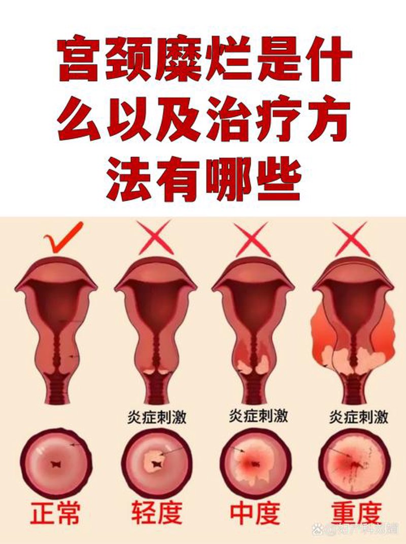 商丘妇科医院：把握健康的关键